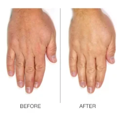 KurHand And Nail Serum 2 In 1 -Exporteren Licht Glam Winkel wxjtRm1063943 2 dgl NL